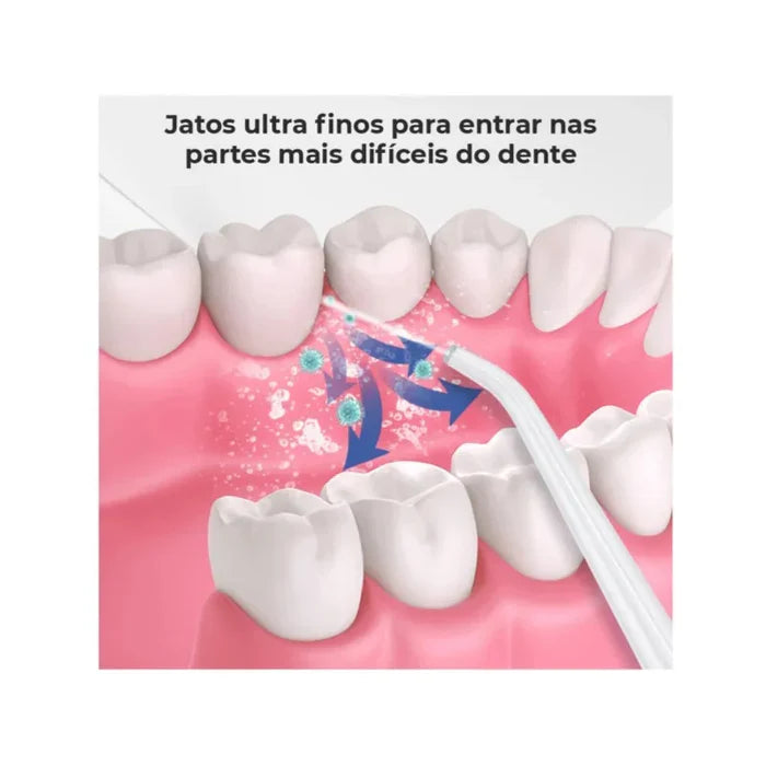 Irrigador Oral Portátil + Kit de Acessórios - HydroSmile Pro