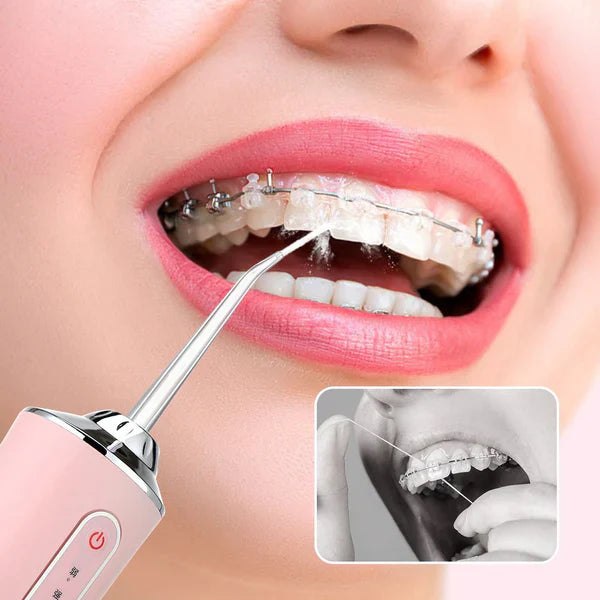 Irrigador Oral Portátil + Kit de Acessórios - HydroSmile Pro
